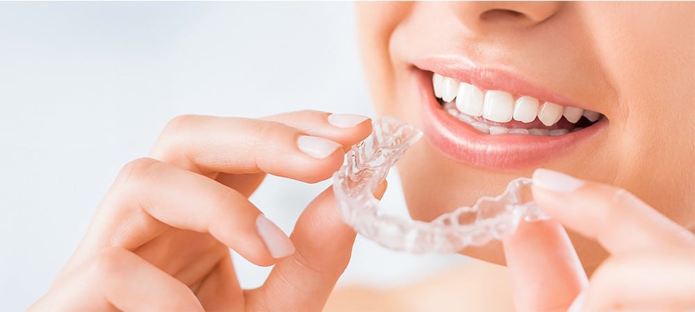 Factors affecting the cost of Invisalign treatment in Canada