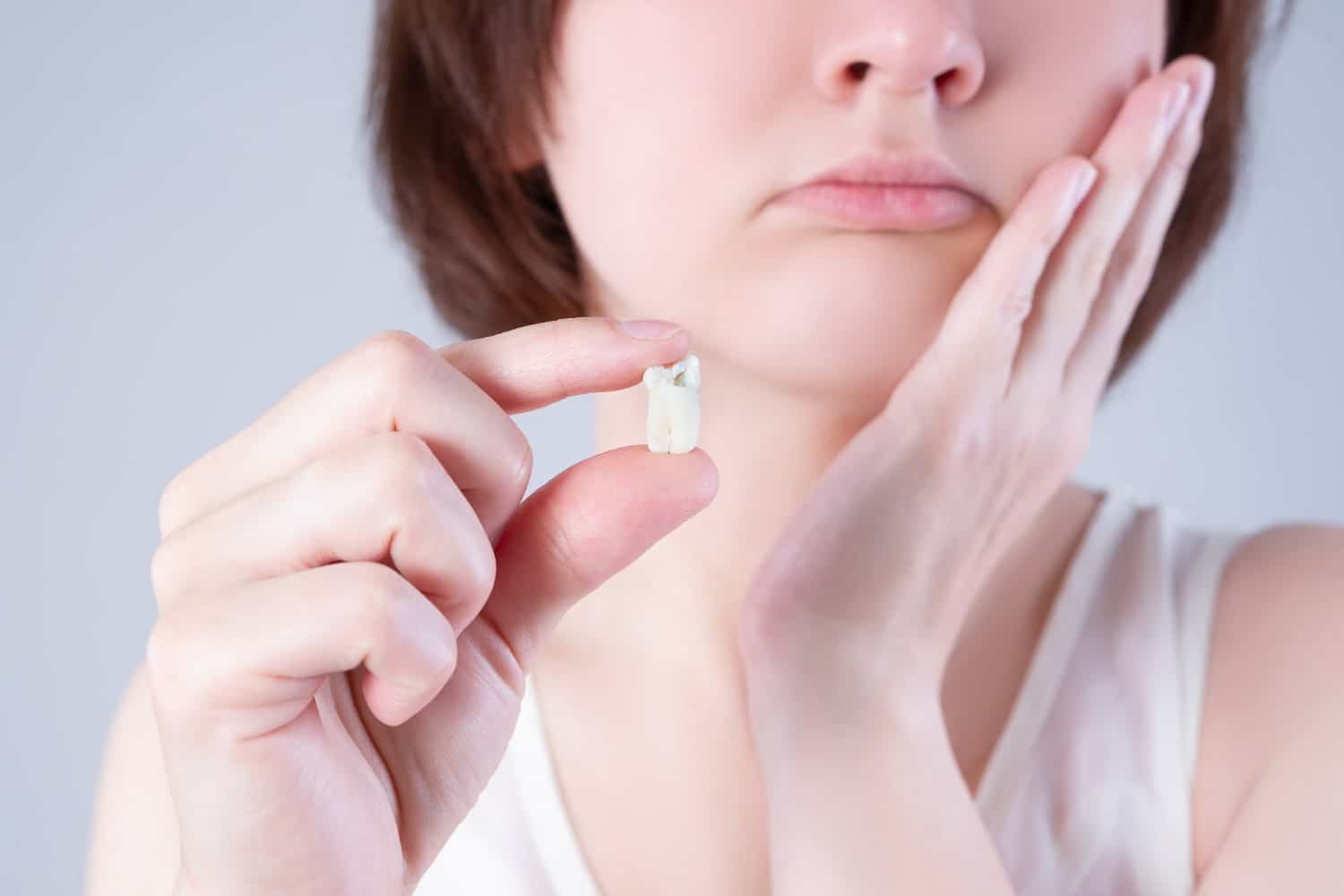 Wisdom Tooth Removal